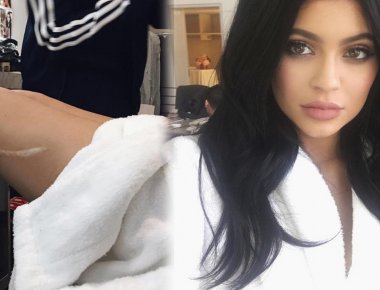 Kylie Jenner: Το σημάδι που έκρυψε στις Χρυσές Σφαίρες